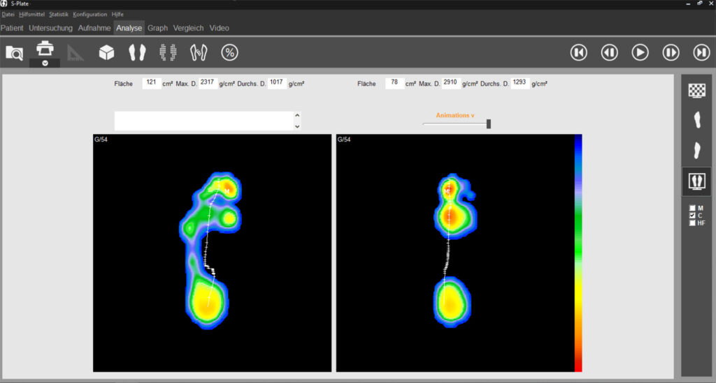 Fußabdrücke mit Belastungsmessung auf dem PC-Bildschirm