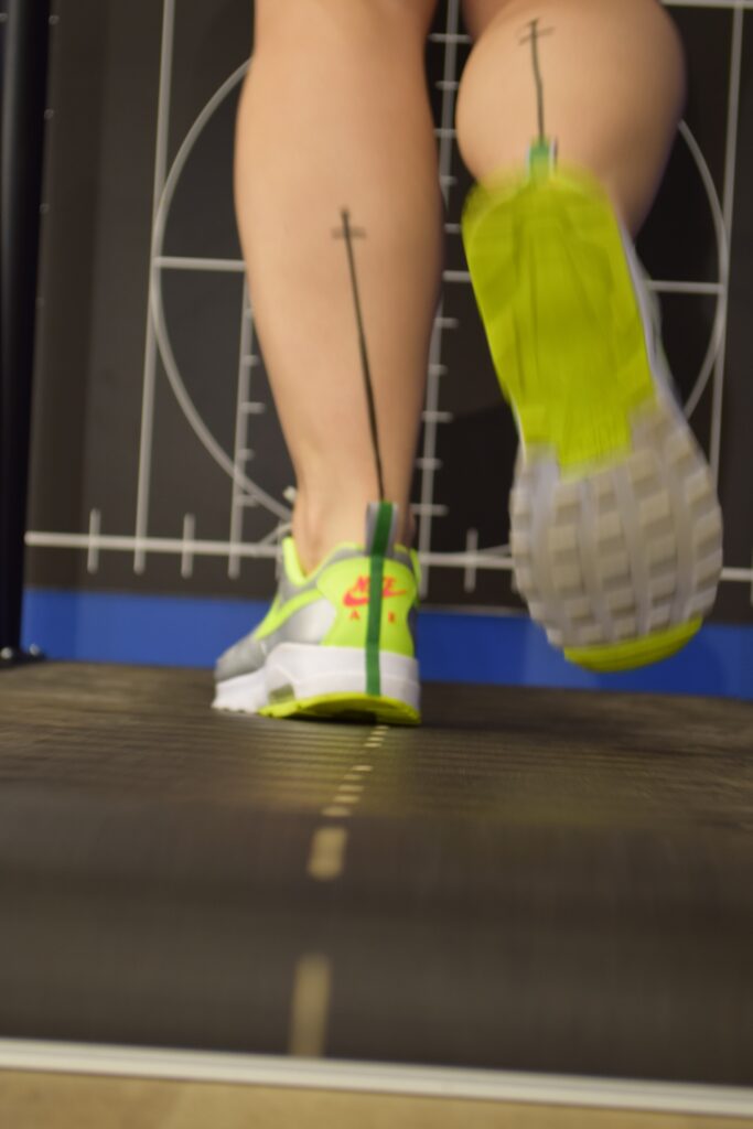 Laufbandanalyse, gelbe Sportschuhe