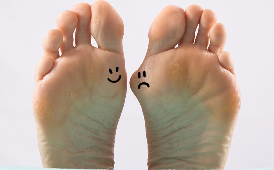 hallux valgus und gesunder Fuss
